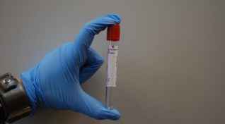 Image of a test tube used in dengue diagnostics.